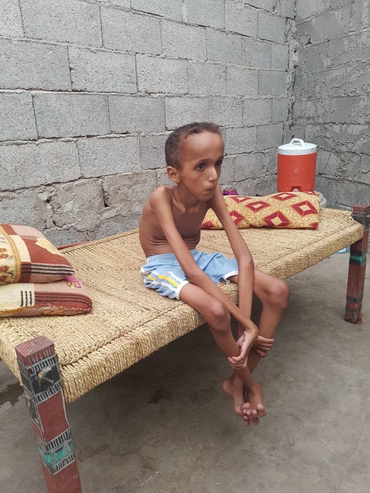 Treatment of 500 Yemeni handicapped children