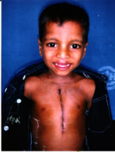 Ram Showing off his scar