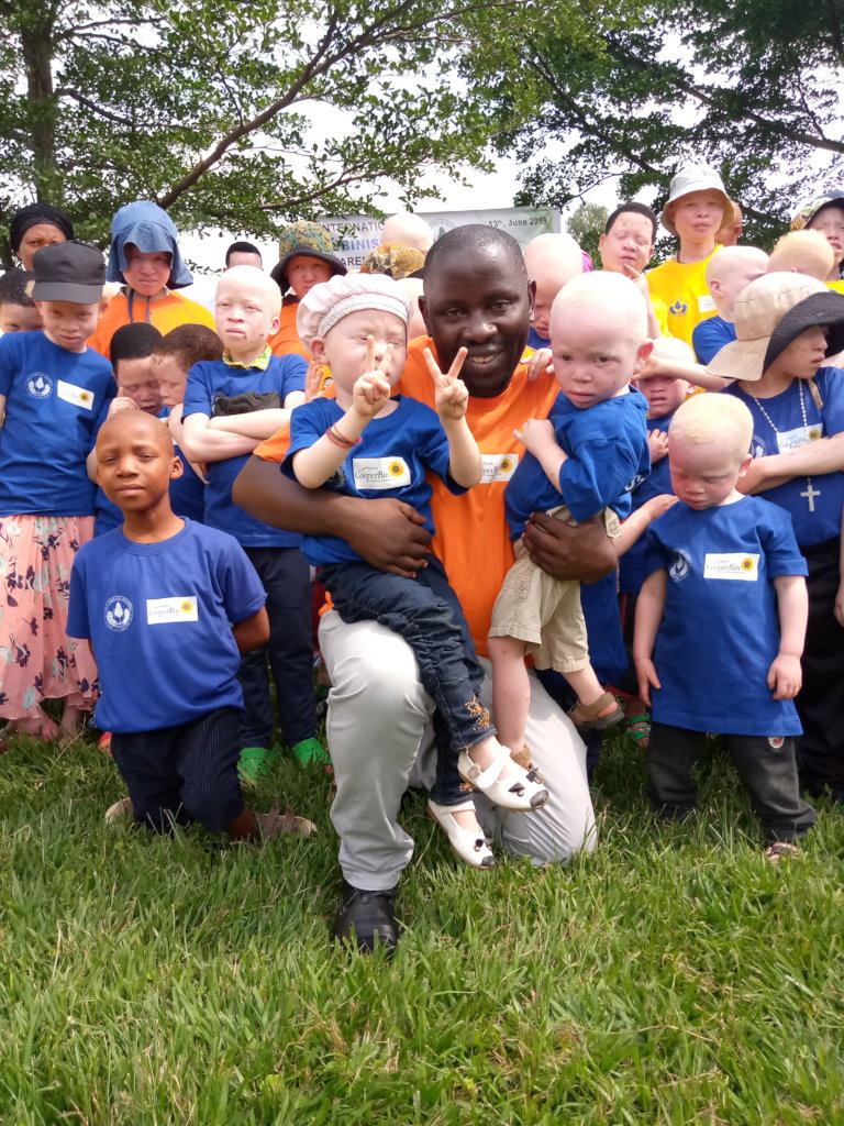 Education and Healthcare for 81 Albinos in Rwanda