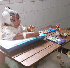 A Guatemalan Volcano Survivor