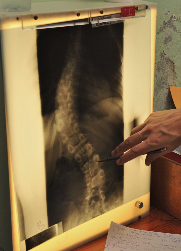 Dr. Sharps evaluates an x-ray