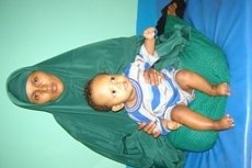 Mobility Aid for 500 disabled children in Somalia