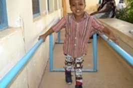 Yahye, 3 years, with Polio paralysis, after treat.