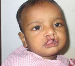 Ayush waiting for his surgery
