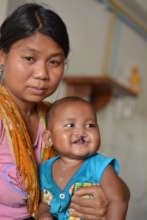 Mothers Trained on feeding cleft children