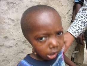 One of children in our care being taken to clinic