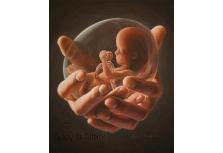 Many 24 week Preemies Are Viable