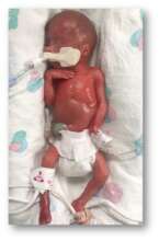 Our Tiny Angel