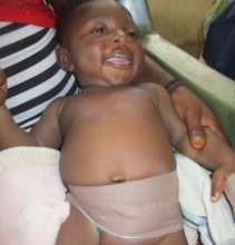 Daniel smiling after operation