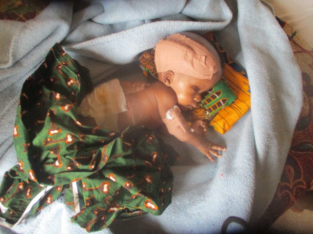 Life-saving surgery for 24 children in S.E Nigeria