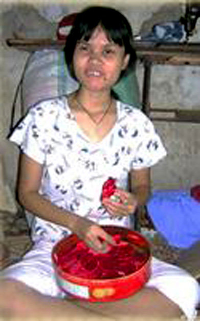 Vocational training,  job creation for young PWDs