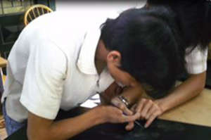Nguyen Van Thuong, both hands do not have fingers
