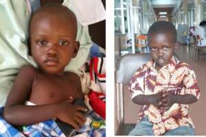 Jonathan Pre and Post Treatment