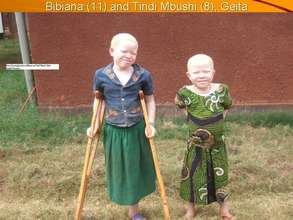 A Victim of barbaric acts against Albino in TZ