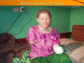 Safe Water to 120 Albino Families in Tanzania