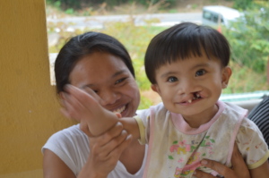 2 For 1 - Cleft Palate & Heart Surgery Candidate