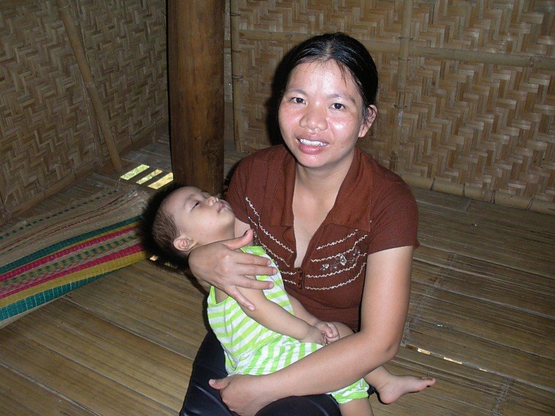 Children's Heart Surgery Program