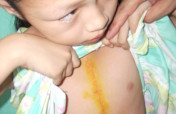Children's Heart Surgery Program