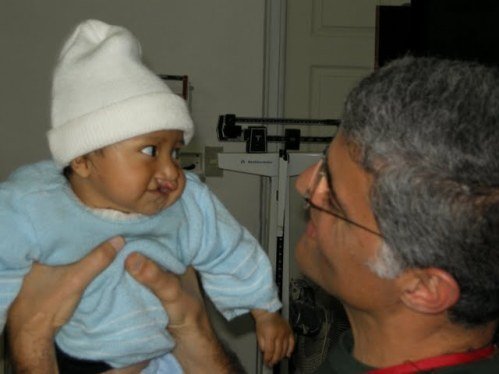 Life-changing surgery for the poor of Guatemala