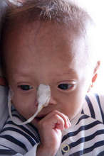 Brave little patient