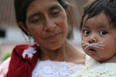 Life-changing surgery for the poor of Guatemala