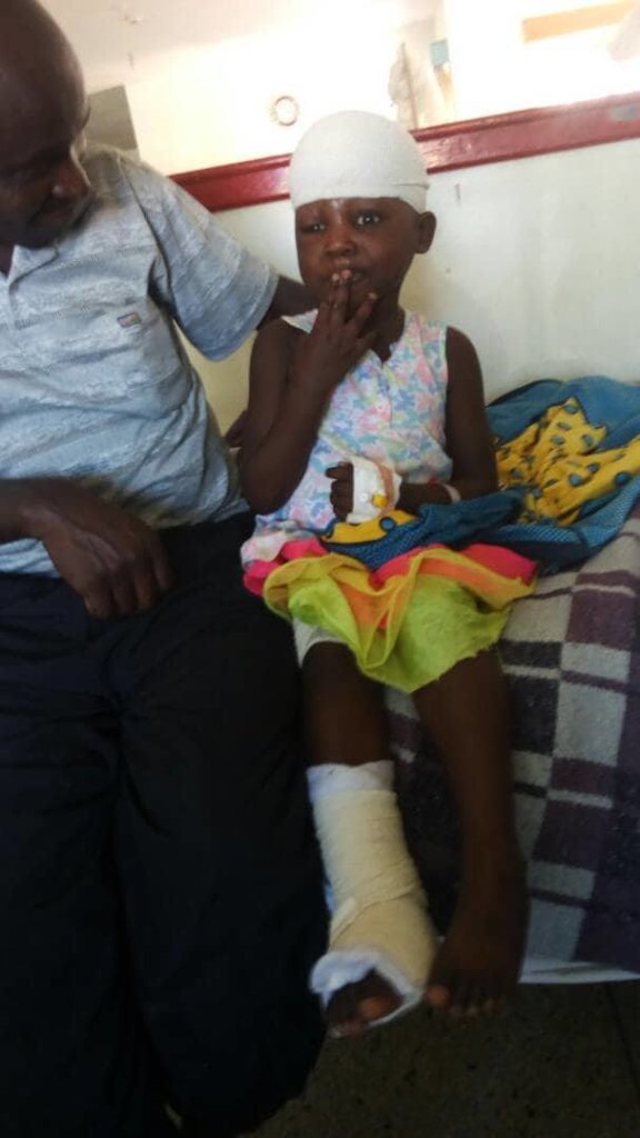 Plastic surgery for Gift, a victim of car accident