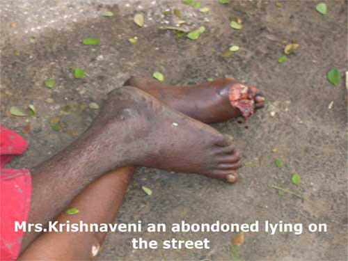 Provide Rescue Vans to 100 DyingDestitute in India