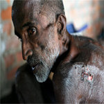 Provide Rescue Vans to 100 DyingDestitute in India