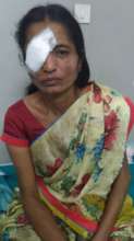46 yr old opearated with vitrectomy surgery