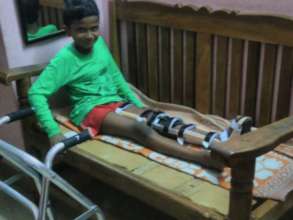 Tharun can now walks comfortably with his walker