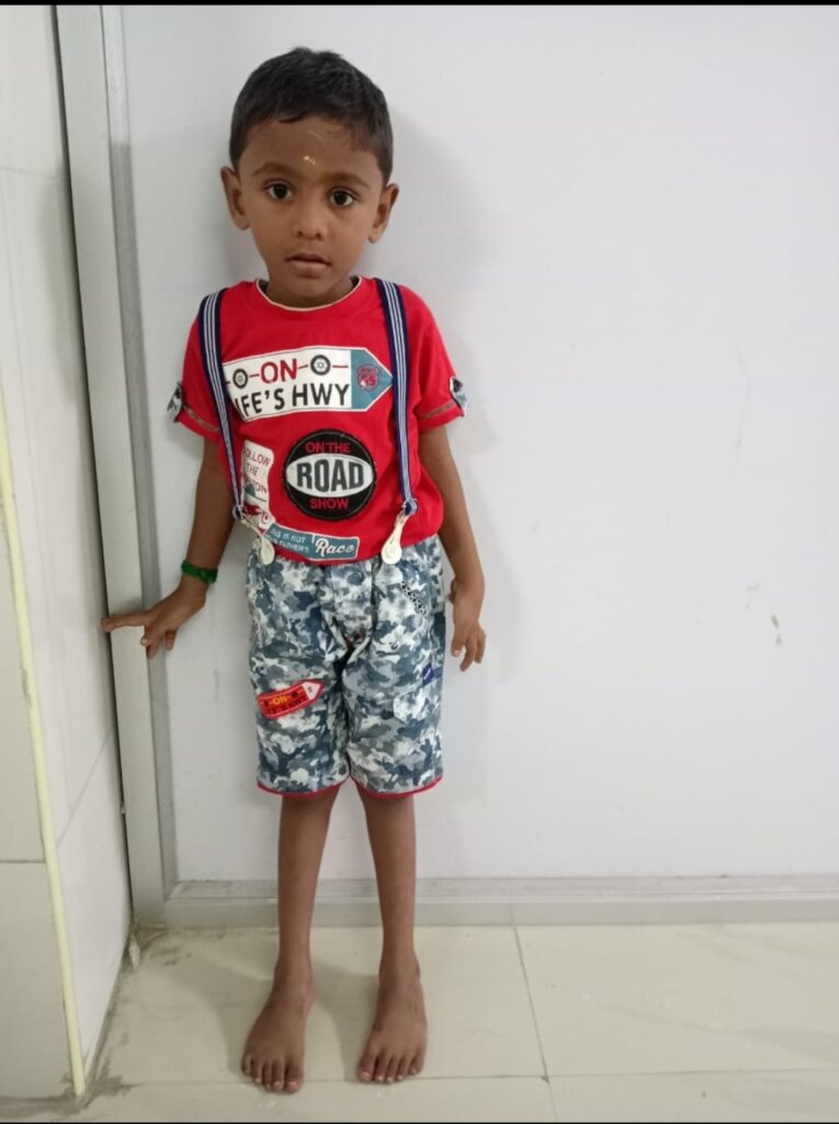 Varshan without the orthotic clubfoot shoes