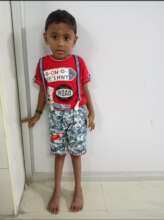 Varshan without the orthotic clubfoot shoes