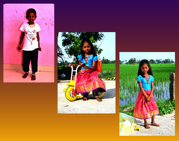 Empower 800 children with birth defects in Chennai