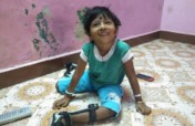Empower 800 children with birth defects in Chennai