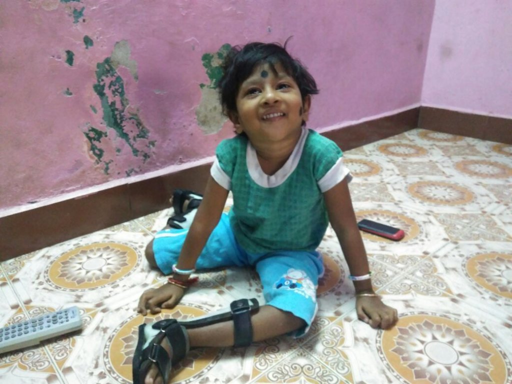 Empower 800 children with birth defects in Chennai