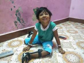Empower 800 children with birth defects in Chennai