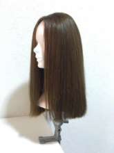 Wig for an alopecia patient