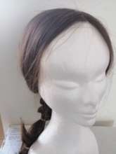 Wig for a cancer patient