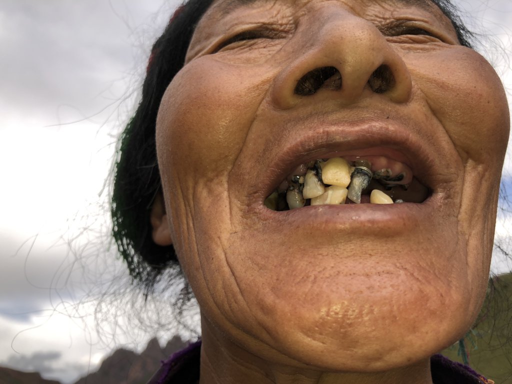 Dental Mission for Tibetan Nomads of Yushu 2019