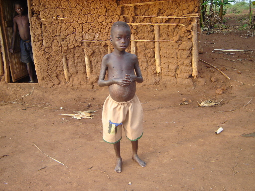 Support AIDS-Affected Households with Food