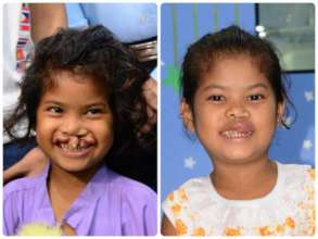Fund a Life Saving Defibrillator for Kids' Surgery