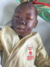 Needed an emergency CT scan after an accident