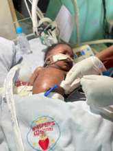 one of our neonates that are usually referred