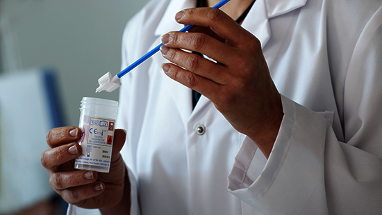 Cervical Cancer Screening for women in Kosovo