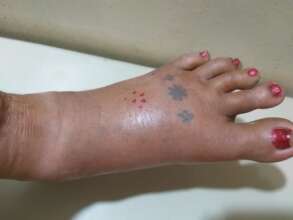 Let's work together to reduce snakebite incidents.