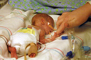 Help the teenage mother and her unprotected baby - GlobalGiving