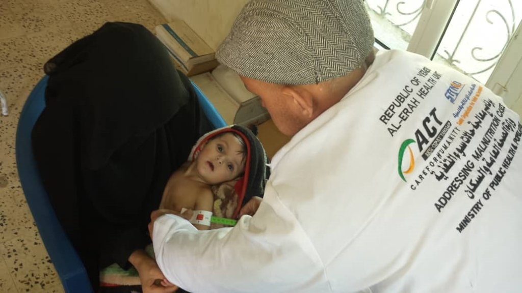 Malnutrition children U5yr &  PLW in Yemen