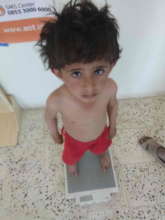 Zero-Score to identified type of malnutrition SAM