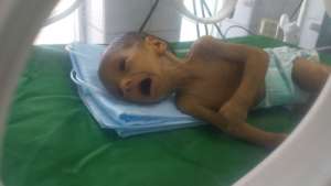 Newborns are malnourished