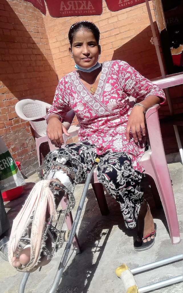 Medical care & rehabilitation changing lives Nepal